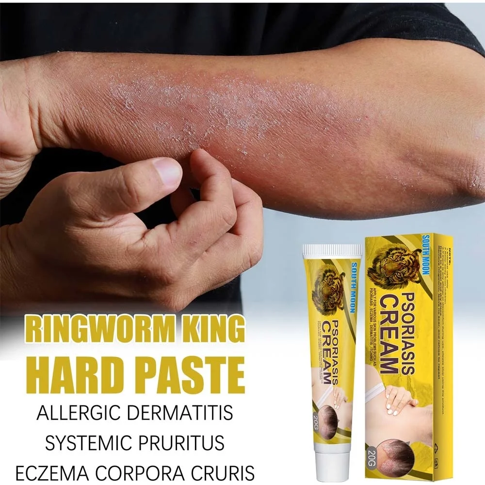 

Effective Psoriasis Eczema Treatment Cream Herbal Antibacterial Ointment Anti-itch Relief Rash Urticaria Desquamation Body Care