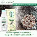 Травяной шампунь Zudaifu для ухода за волосами, псориаз, себорный лечебный экзема, дерматит, 120 мл