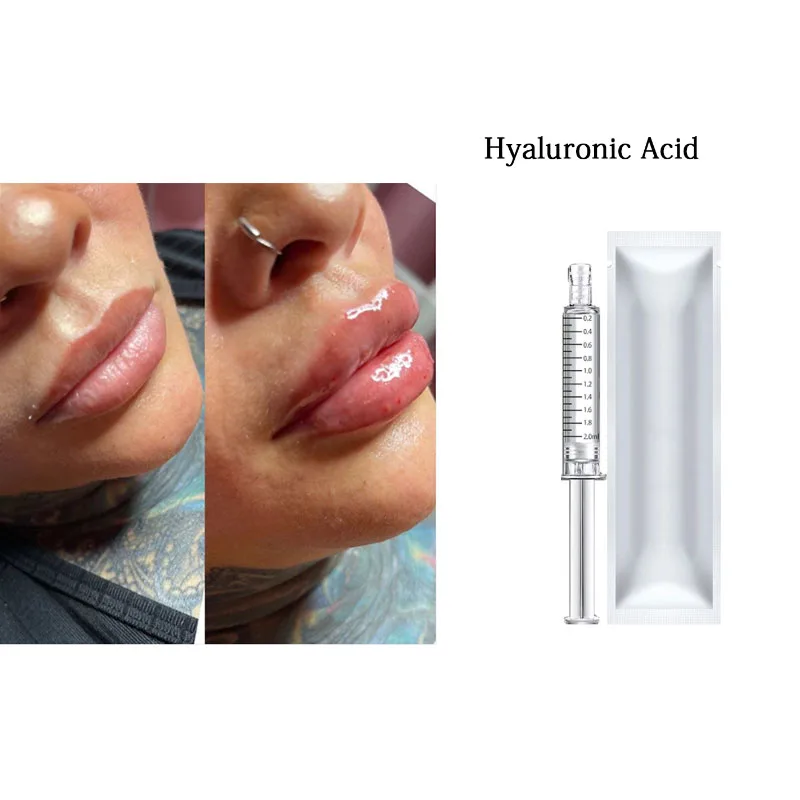 

2ml Hyaluronic Acid Serum Lip/Nose/Cheek Hyaluronic Acid Crosslinked HA Lips Enhancement for Hyaluron Pen Remove Wrinkles Kroea