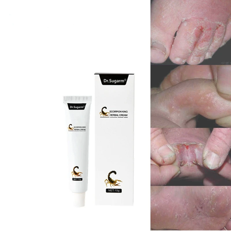 

1PC/5PCS Herbal Foot Cream Fungus Treatment Anti Fungal Onychomycosis Paronychia Toe Feet Repair Care Feet Care