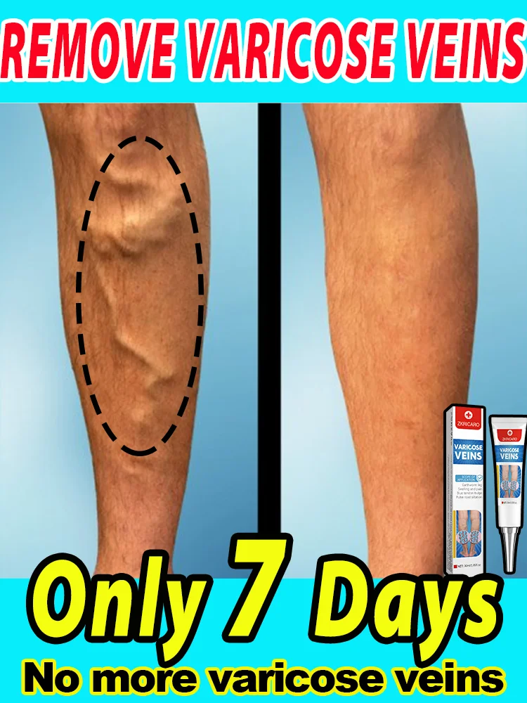 Продвижение крови