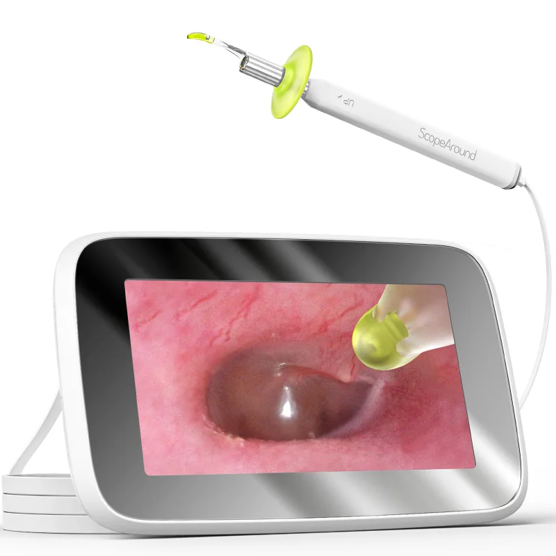 

Profesional earwax cleaning tool 3.9mm ear endoscope camera with 4.3 inch hd screen ear cleaner digital otoscope