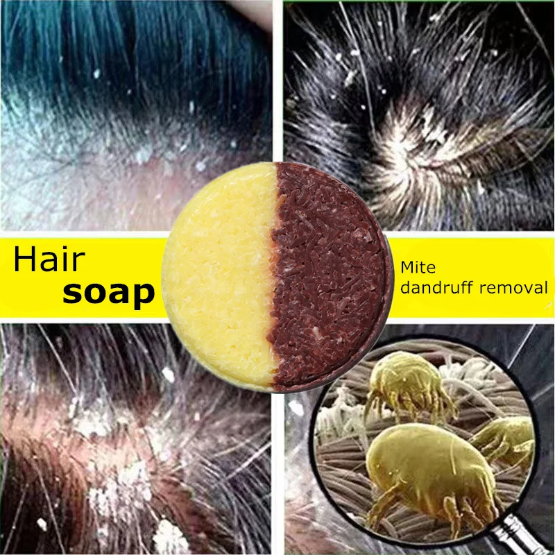 Seaweed Dandruff Shampoo Portable Solid Soap Relieve Itching Anti Flakes Scalp Treatment Moisturizing Hair Care Travel keratin