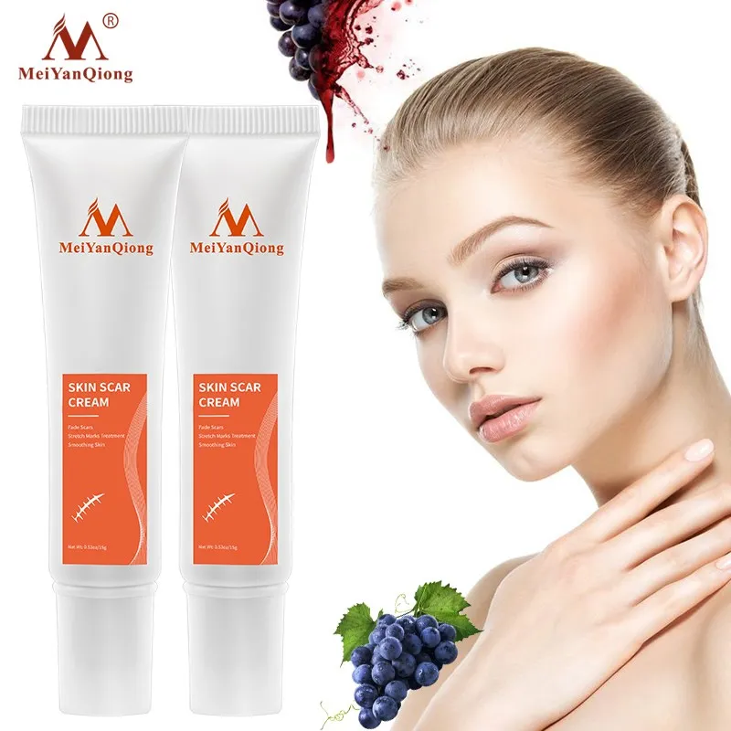 

2 шт./лот травяной экстракт для лица против черных точек, крем для удаления рубцов, угрей, акне, уход за кожей, отбеливающий крем