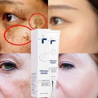 whitening freckles cream remove dark spots melasma melanin remover gel moisturizing brighten blemish facial skin care products