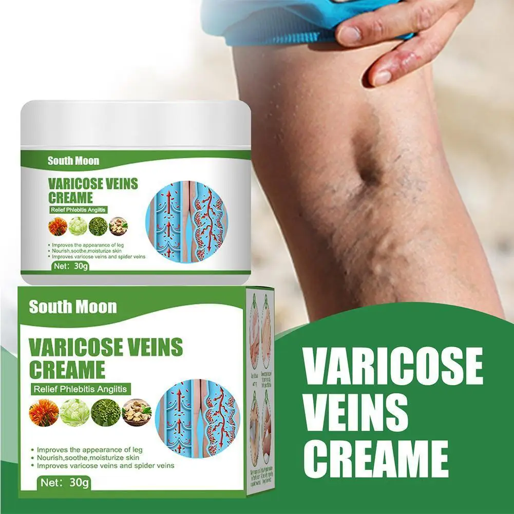 

30g Varicose Veins Treatment Cream Leg Phlebitis Vasculitis Ointment Varicosity Swelling Pain Relief Spider Removal Plaster