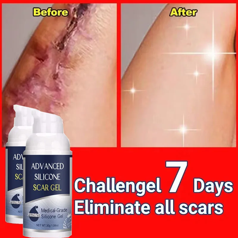 

Fast Scar Removal Cream Effective Remove New Old Scars Repairing Acne Marks Burn Surgical Scar Smoothing Body Skin Beauty Health