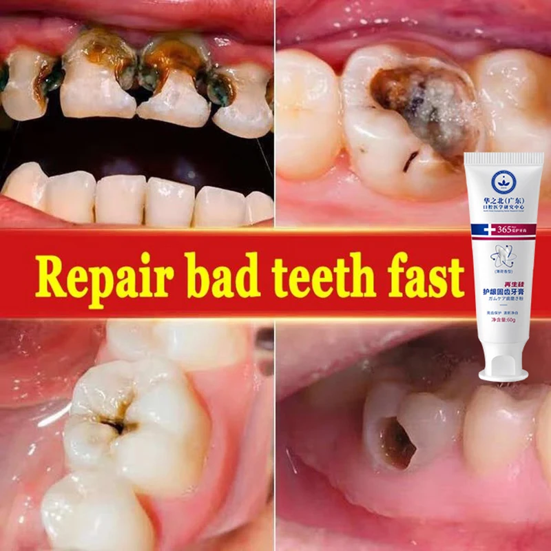 

Rapid repair of dental caries, removal of dental plaque, yellowing, reduction of many oral bacteria, bad breath, and oral ulcers