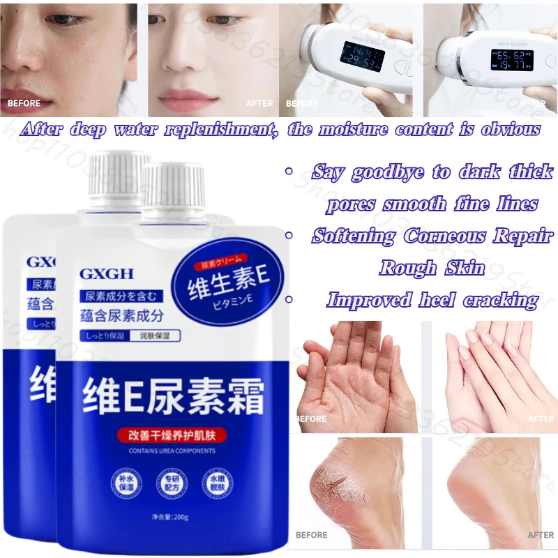 Витамин E крем urea для улучшения грубой куриной кожи глубокое увлажнение защита от