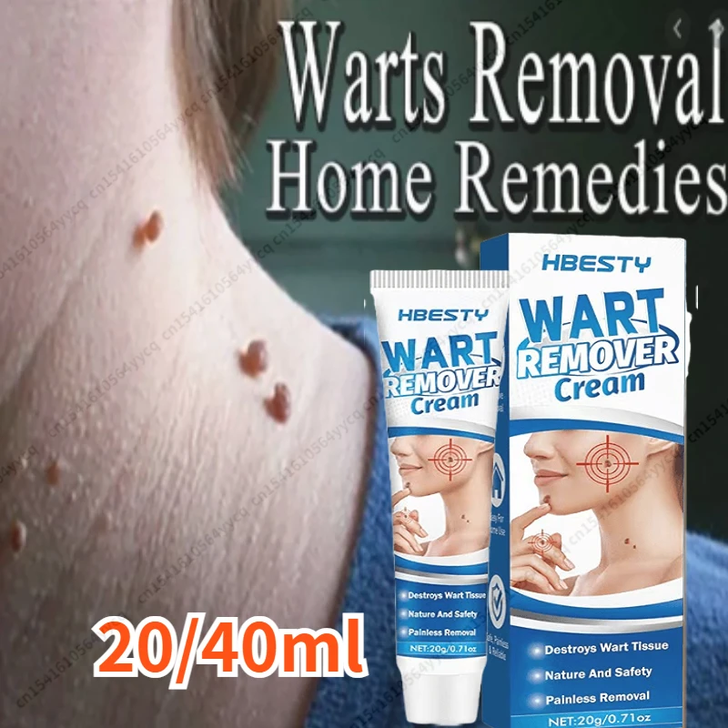 

40g Skin Tag Remover Cream Painless Mole Skin Dark Spot Warts Remover Serum Freckle Face Wart Tag Treatment Removal Essential