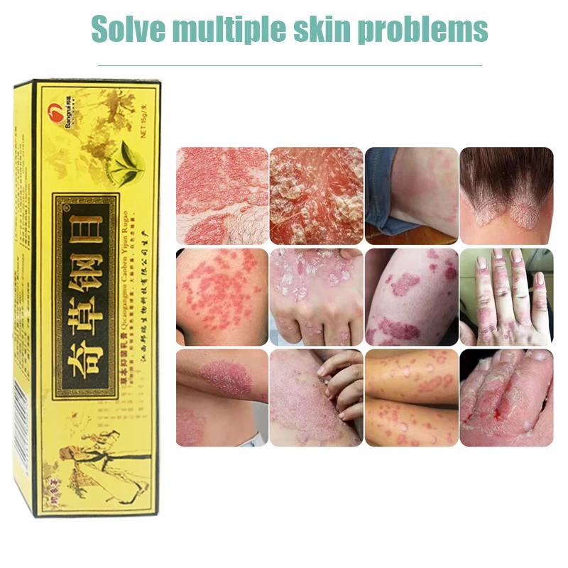 1 шт. magic grass gangmu YG-2134