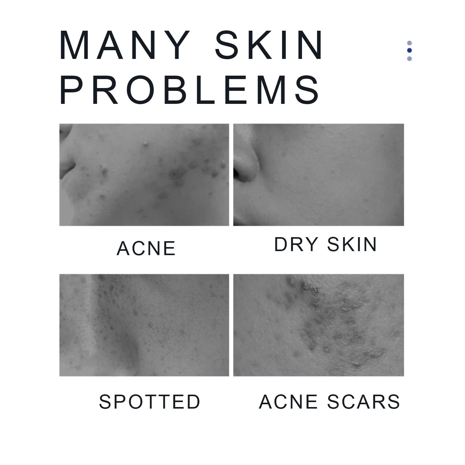 Новое поступление увлажняющая сыворотка для лица Lanthome Beyond Basix 15% Витамин C (2 шт.)