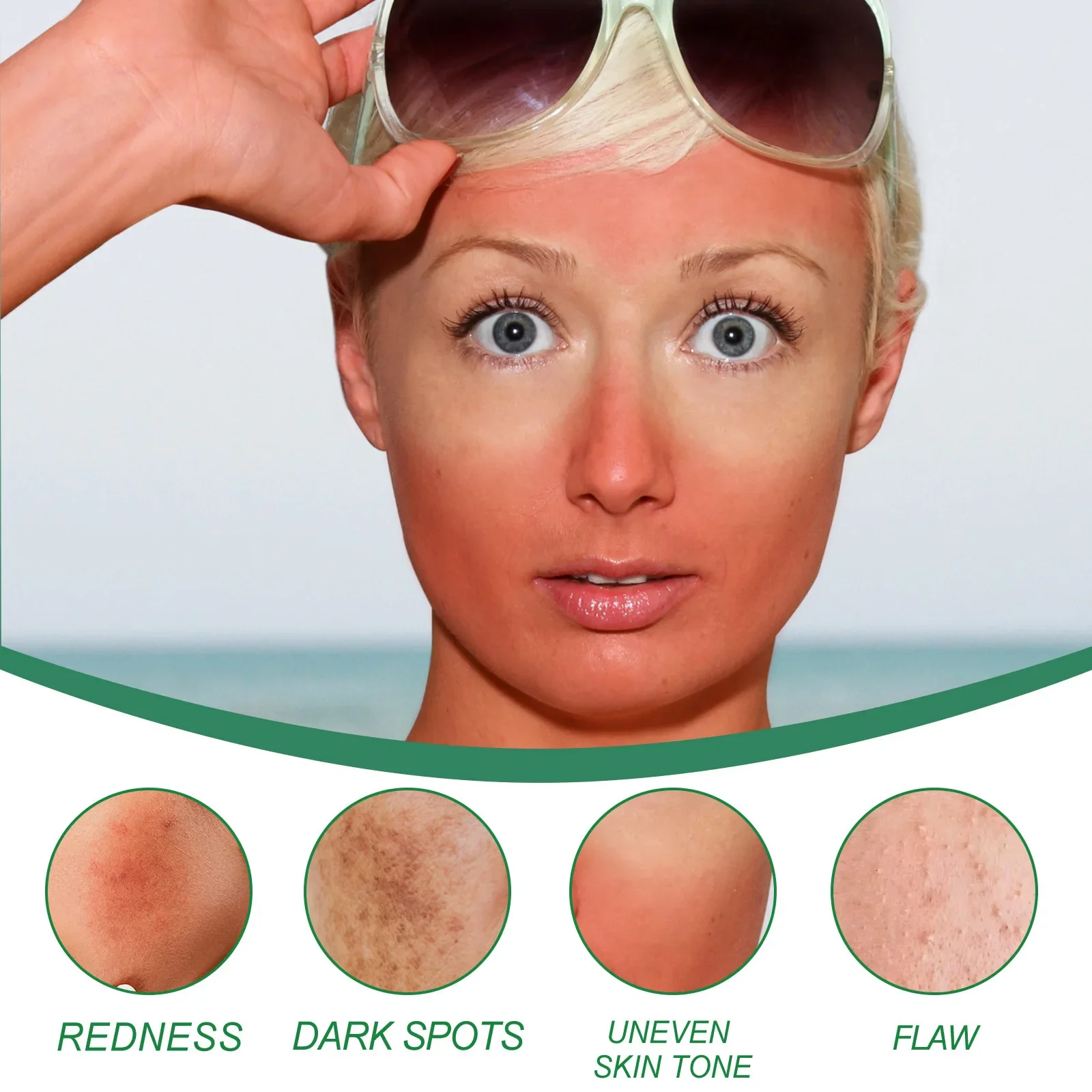 Увлажняющий крем для покраснения кожи лица улучшения чувствительной сухости