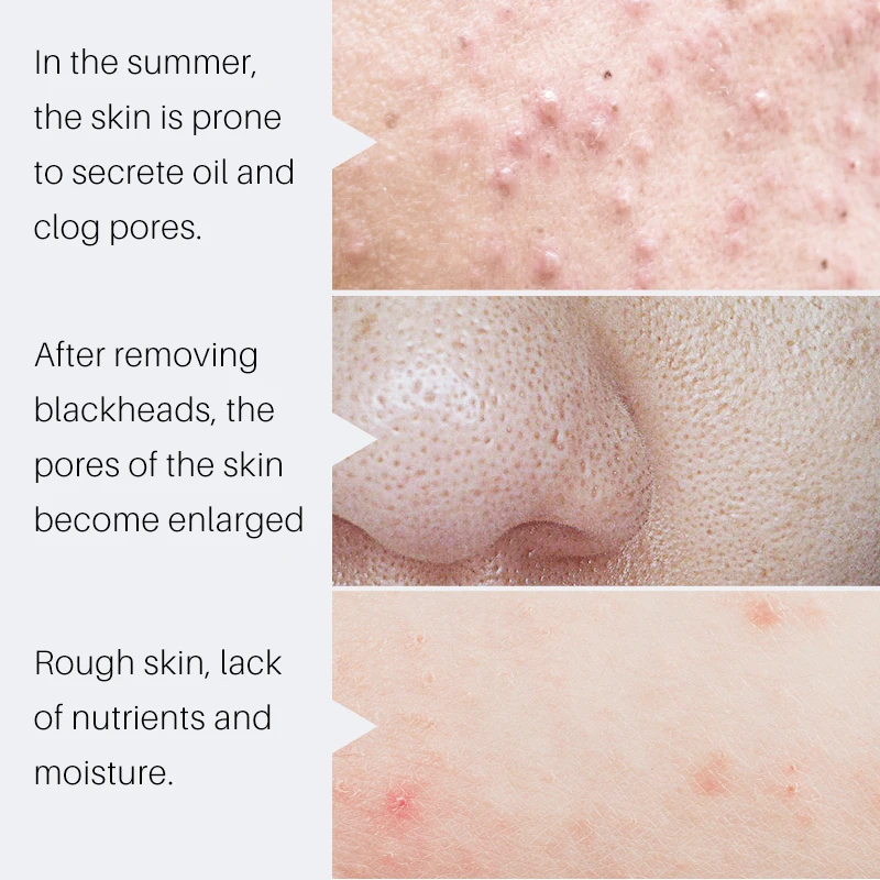 Сыворотка для контроля пор Pro Skincare сужает поры и подтягивает кожу очищает 10 мл/0 34