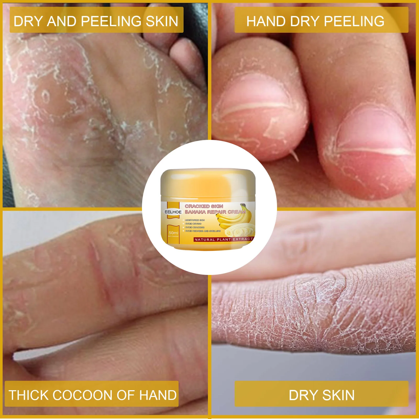 Cracked skin Banana Repair Cream Chapped skin moisturizing cream Body care moisturizes the skin Moisture Anti dry crack