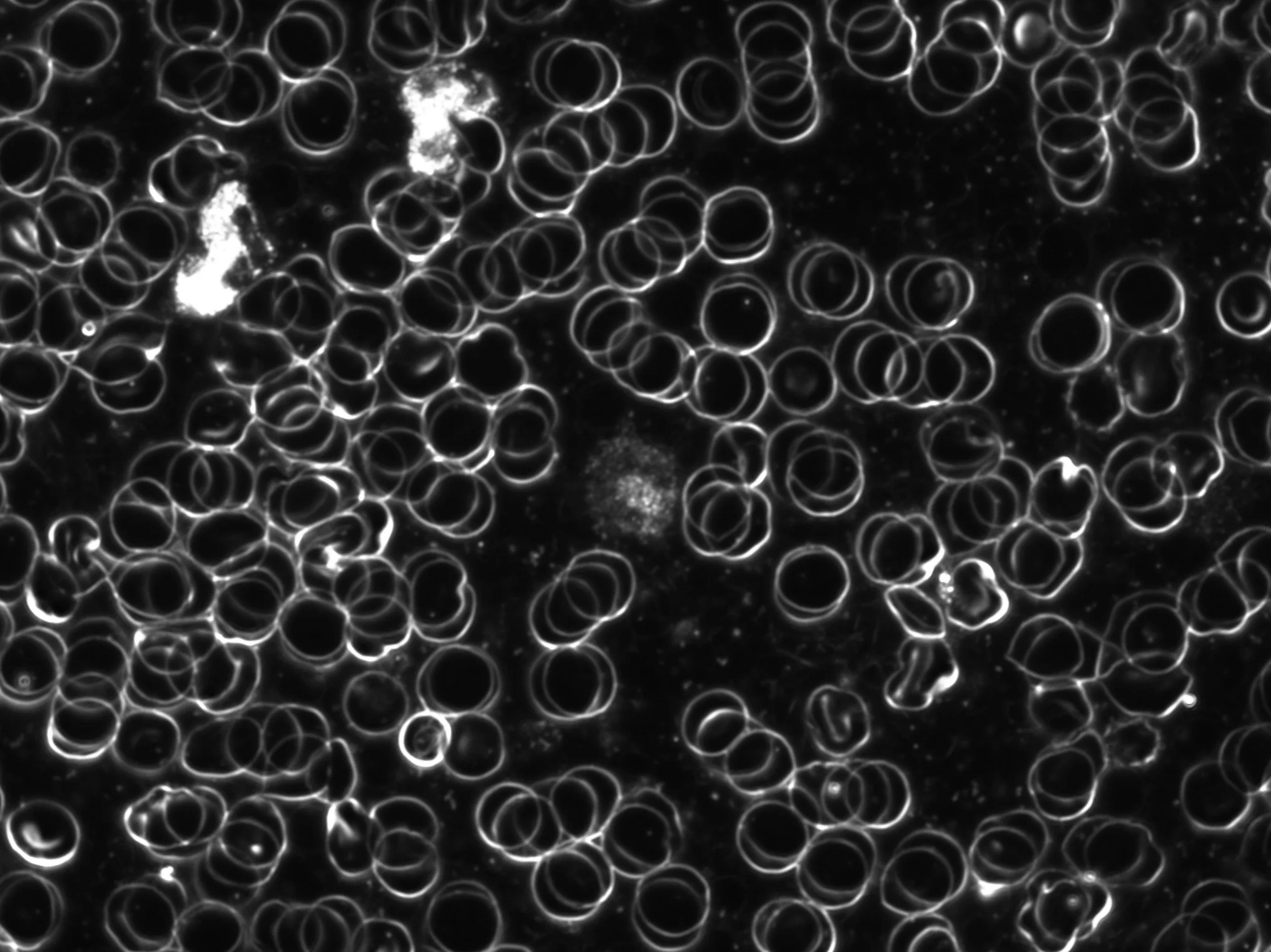 BestScope BS-2041T(DF) 4X 10X 40X 100X объективный тринокулярный биологический микроскоп темного