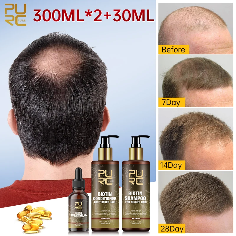 PURC Biotin Hair Growth Products Set Fast Hair Growing Oil Prevent Baldness Loss Treatment Shampoo and Conditioner Beauty Health