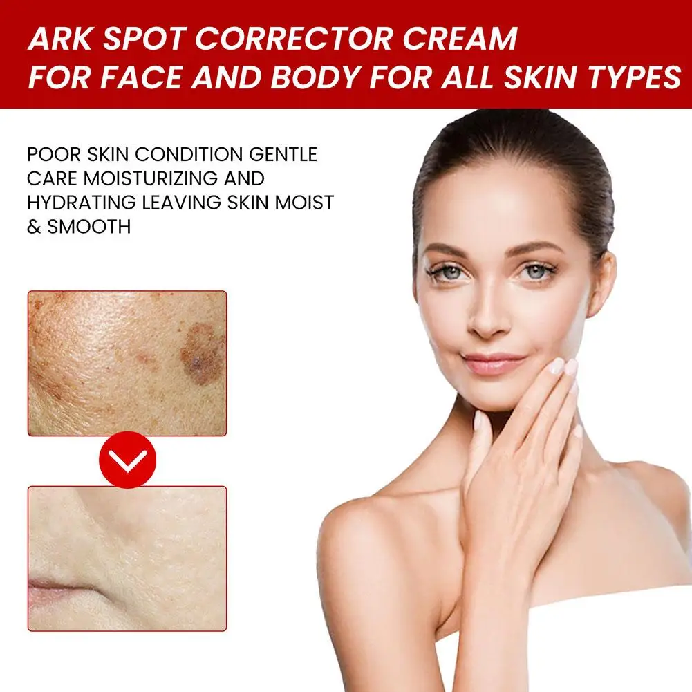 

20g Dark Spot Skin Whitening Fade Cream Lightening Face Reduces Cream Removal Face Cream Aging Blemish Freckles Age Anti Sp O7X4