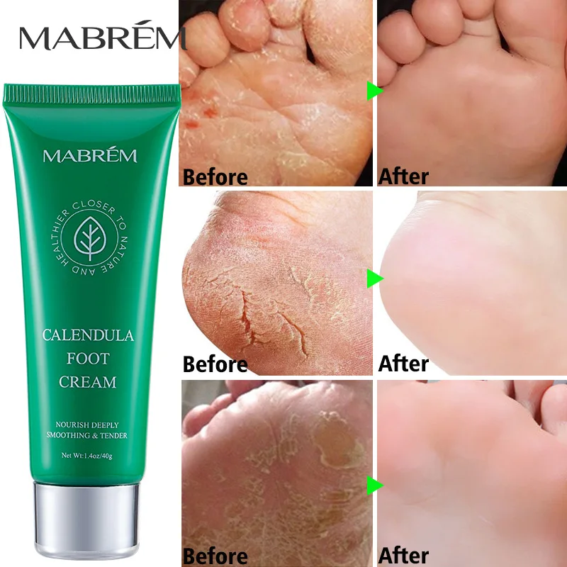 

2PCS/LOT MABREM Foot Cream Pedicure Beauty Wellness Foot Peeling Mask Pedicure Repair Skin Detox Hydration Moisturizing
