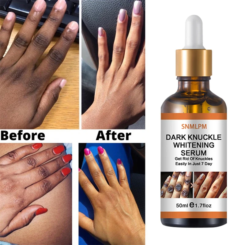 

50ml Dark Knuckles Whitening Serum Elbow Armpit Knee Ankle Brightening Essence Lighten Melanin Dark Knuckle Remover Hand Care