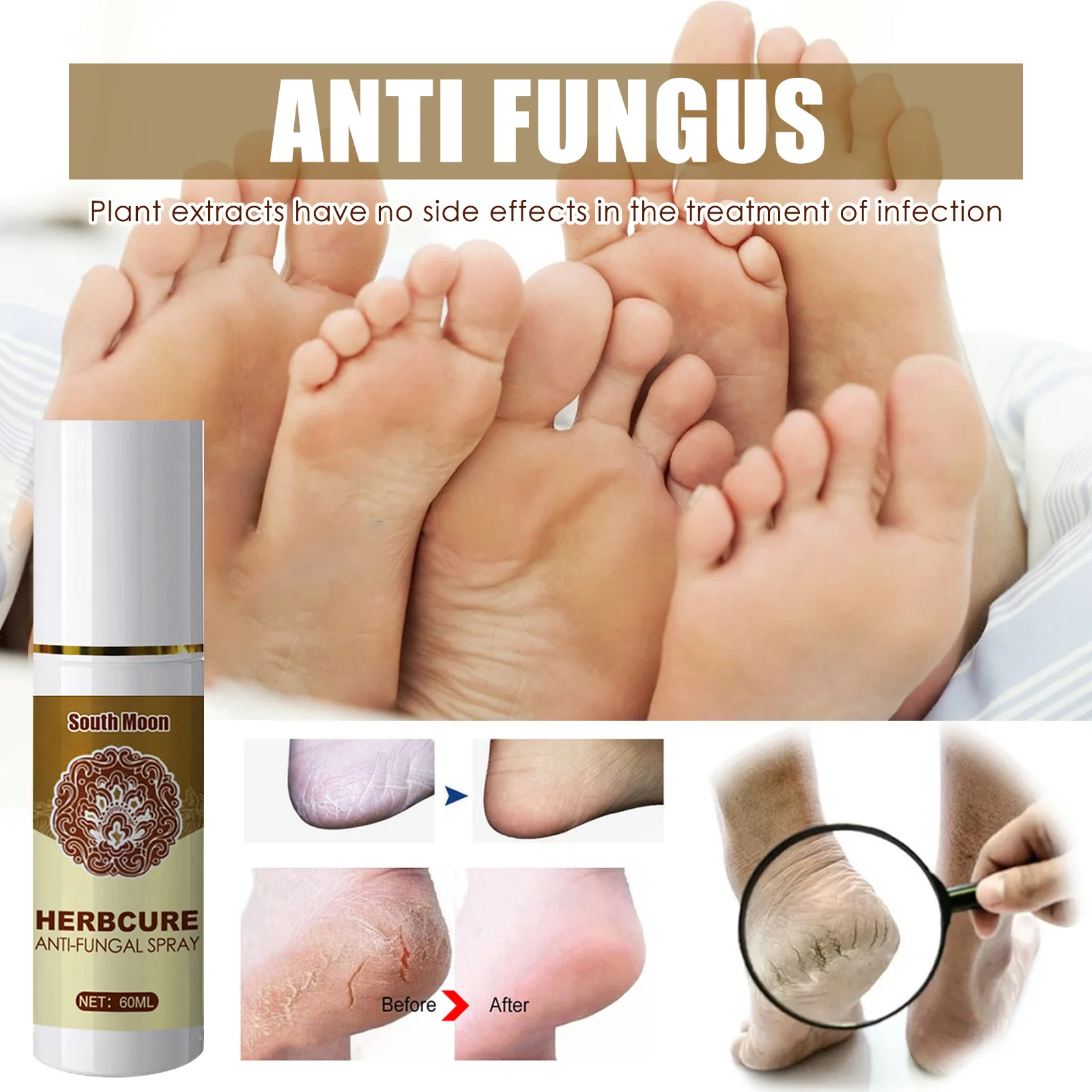 

60 мл травяное Лечение грибка спрей для ног пилинг от зуда для мозолей треснувший Восстанавливающий Противогрибковый спрей уход за ногами А...