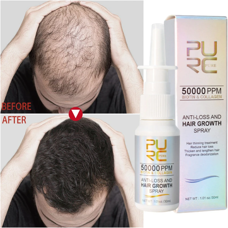 

Мощный спрей для роста волос, эссенция против выпадения волос, лечение и восстановление масла, питание корней волос, регенерация волос для мужчин и женщин