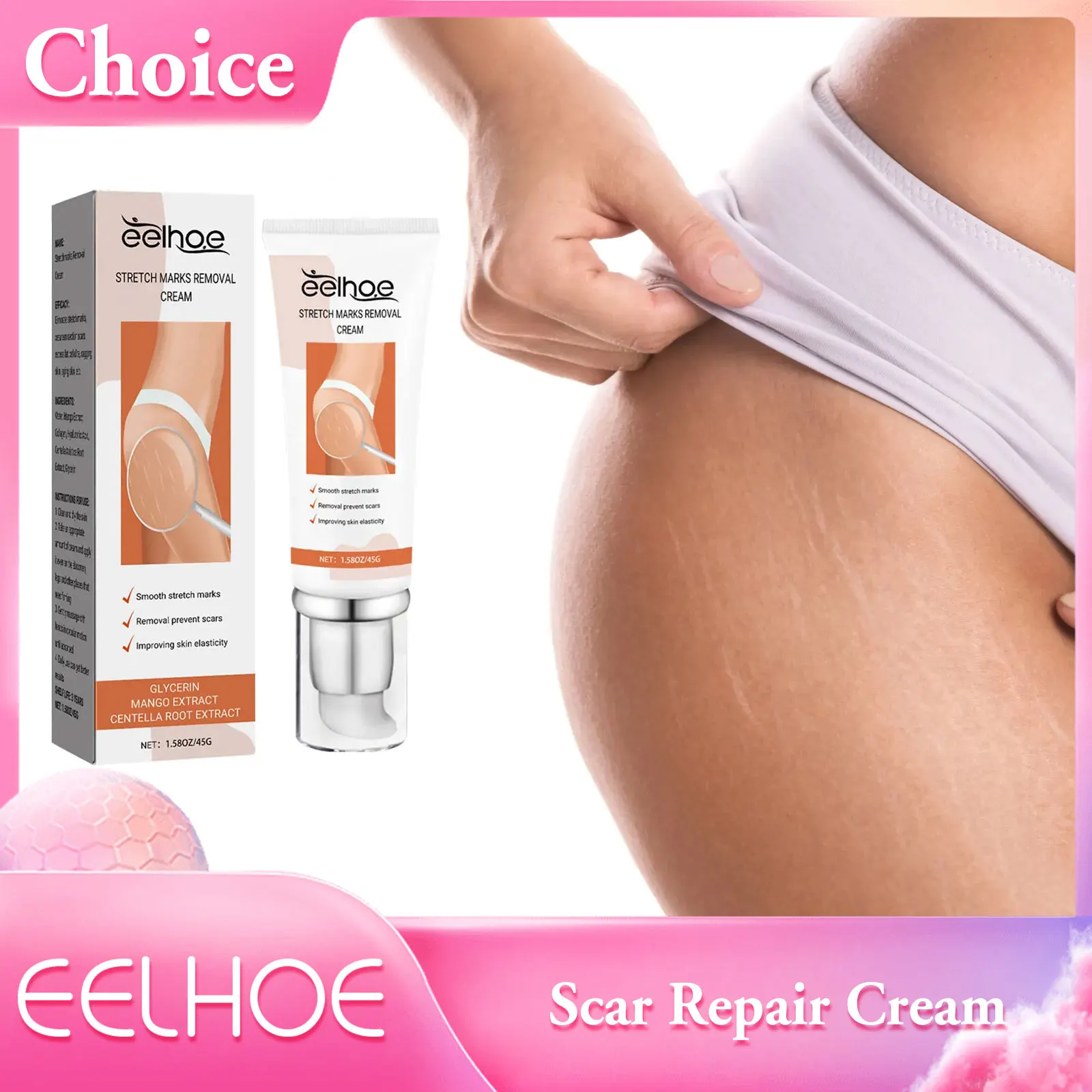 Крем для удаления растяжек послеродовое ожирение беременные женщины против