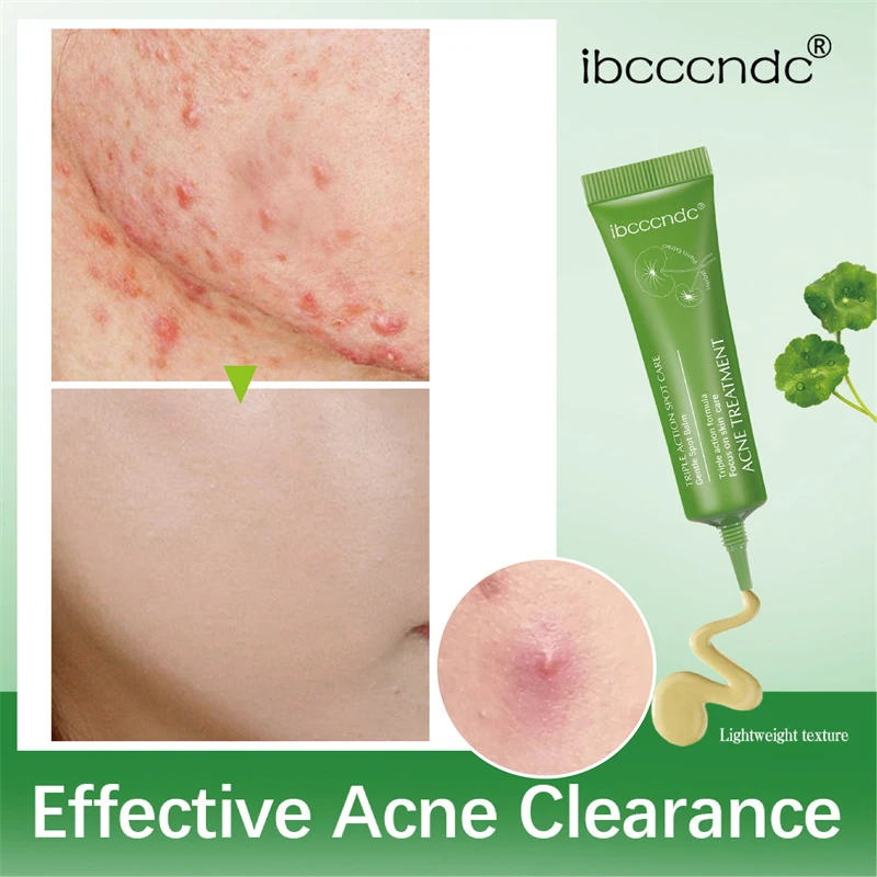 

Acne Removal Face Cream Centella Acne Scar Gel Shrink Pore Oil Control Facial Serum Acne Treatment Skin Care Beauty Health 15g