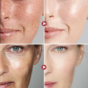 New Whitening Cream Skin Care Emulsifiers Niacinamide Peptide Anti-ageing Face Wrinkl Cream Dark Spot Remove Beauty Health 6