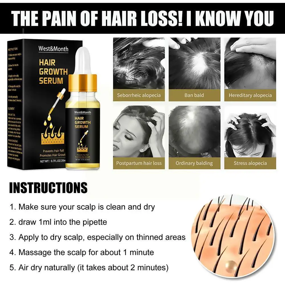 

Имбирная эссенция для роста волос, устройство для роста волос, устройство для предотвращения выпадения кожи головы, лечение волос, массажер...