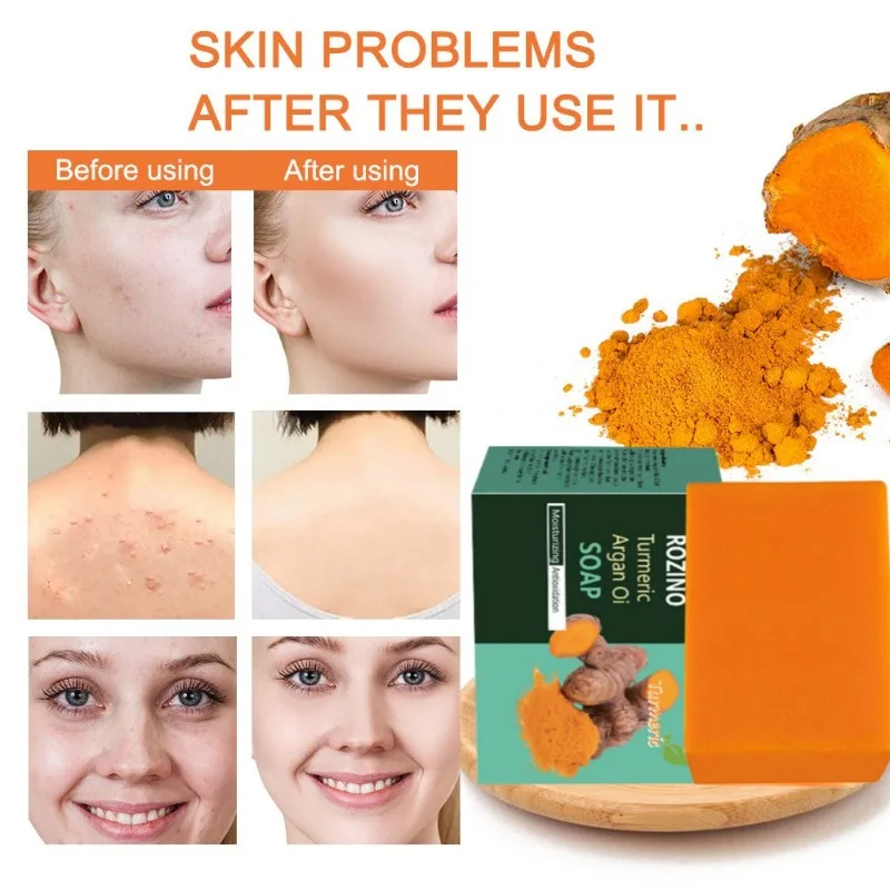 

Turmeric Whitening Soap Brightening Skin Lighten Dark Spot Hand Soap Acne Scar Removal Cleaning Skin Travel Soap Skin Care