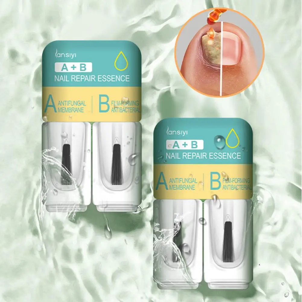 

Nail Fungal Treatment Feet Care Serum Anti Infection Foot Fungus Removal Essence Paronychia Onychomycosis Repair Health Products