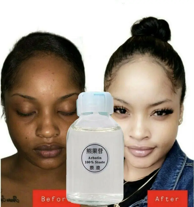 30ml Dark Skin Permanent Whitening Lightening Brightening Bleaching Kojic Acid Serum Women Girls Beauty Free Shipping