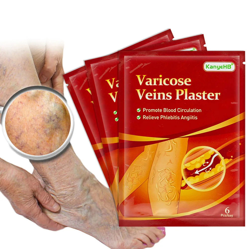 

Foot Care Varicose Veins Patches Natural Herbal Spider Veins Vasculitis Vein Patch Leg Pain Relief Phlebitis Vein Edema Angiitis