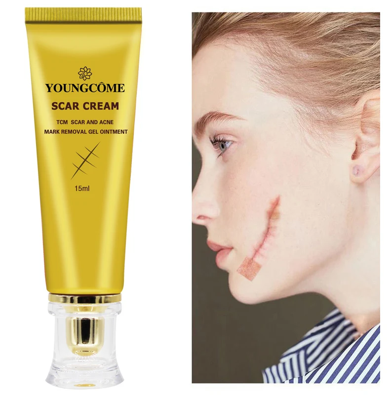 Крем для удаления шрамов от акне Устранение растяжек удаление ожогов