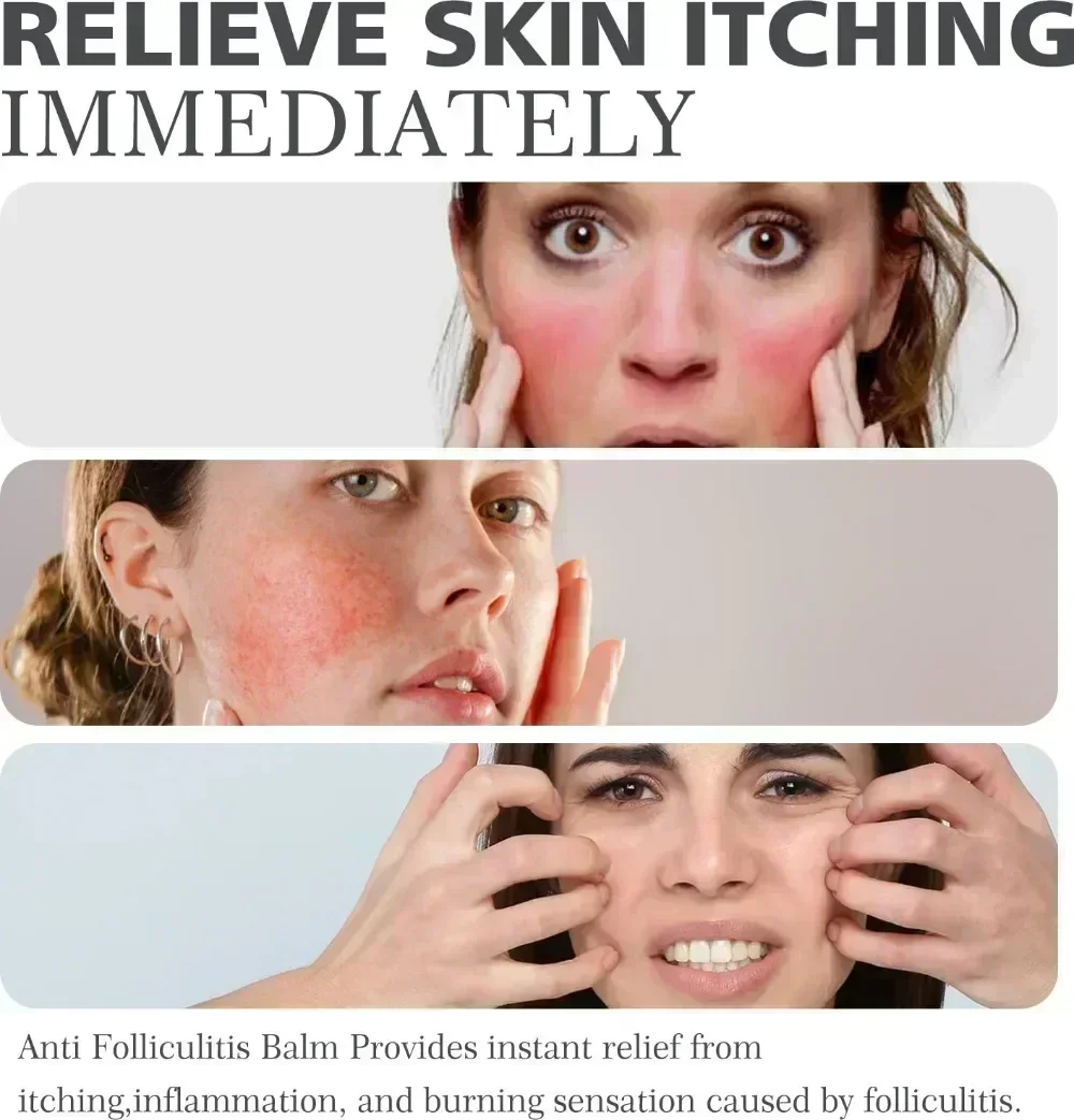 Крем против прыщей эффективно удаляет ножницы кожи кисти бумаги черные точки