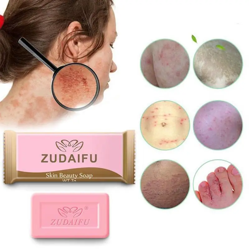 

2/4/5PCS Zudaifu Sulfur Soap Skin Conditions Acne Psoriasis Seborrhea Eczema Anti Fungus Bath Healthy Soaps Eczema Zudaifu Soap