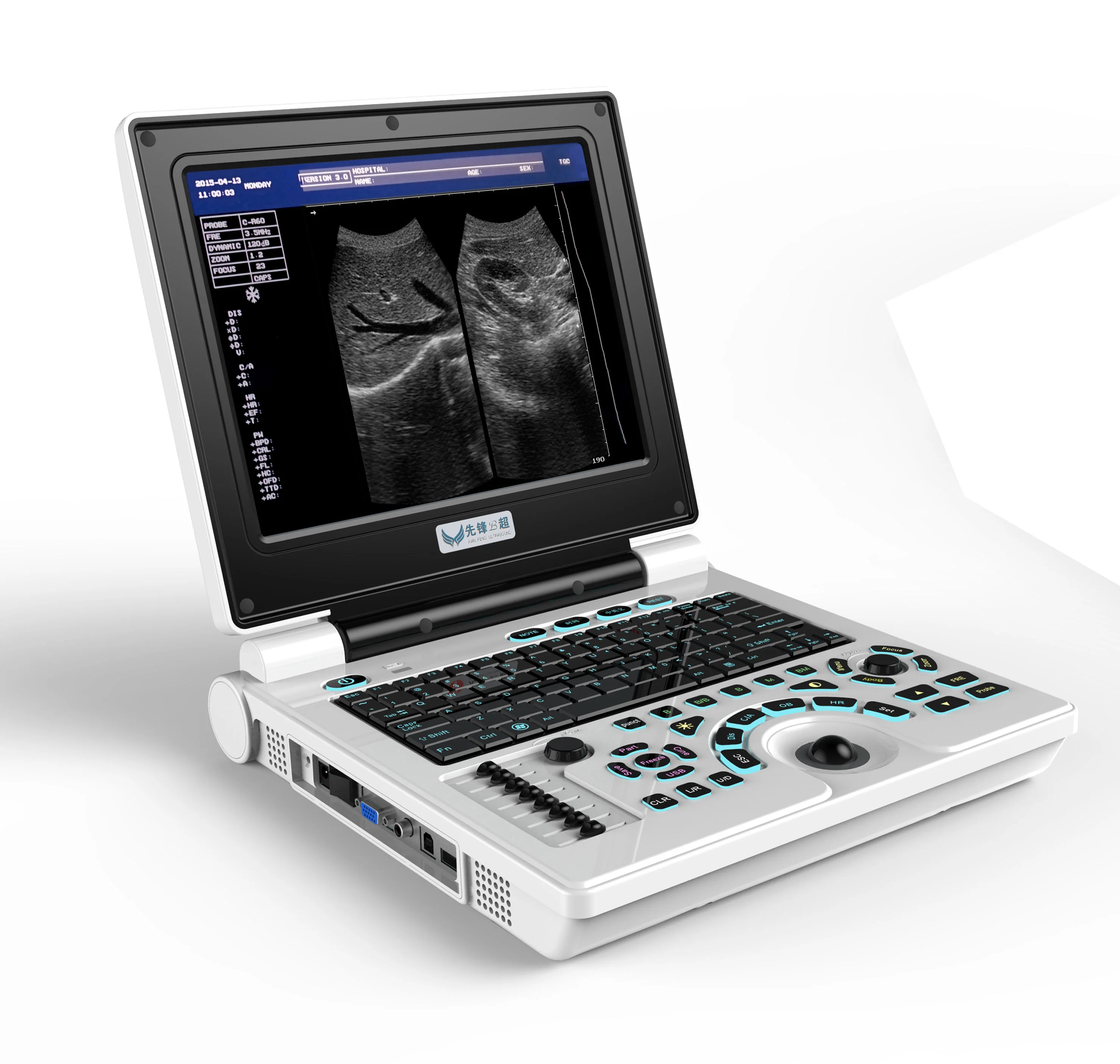 

New Arrival portable10.4 led model veterinary ultrasound scanner for animal use
