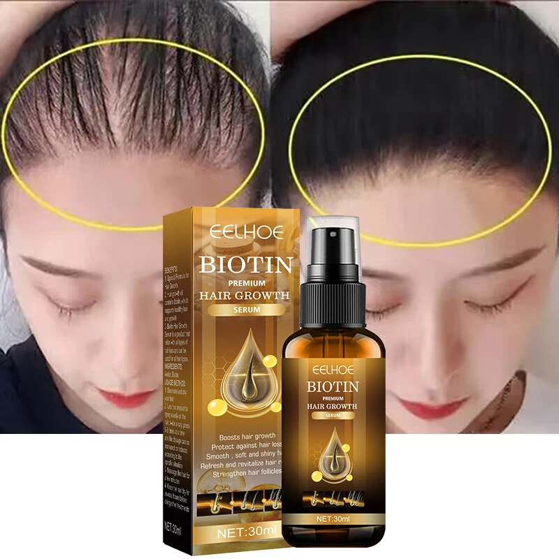 

Ginger Hair Growth Spray Natural Anti Hair Loss Serum Prevent Baldness Strengthen Hair Root Nourishing Scalp Dry Care Products
