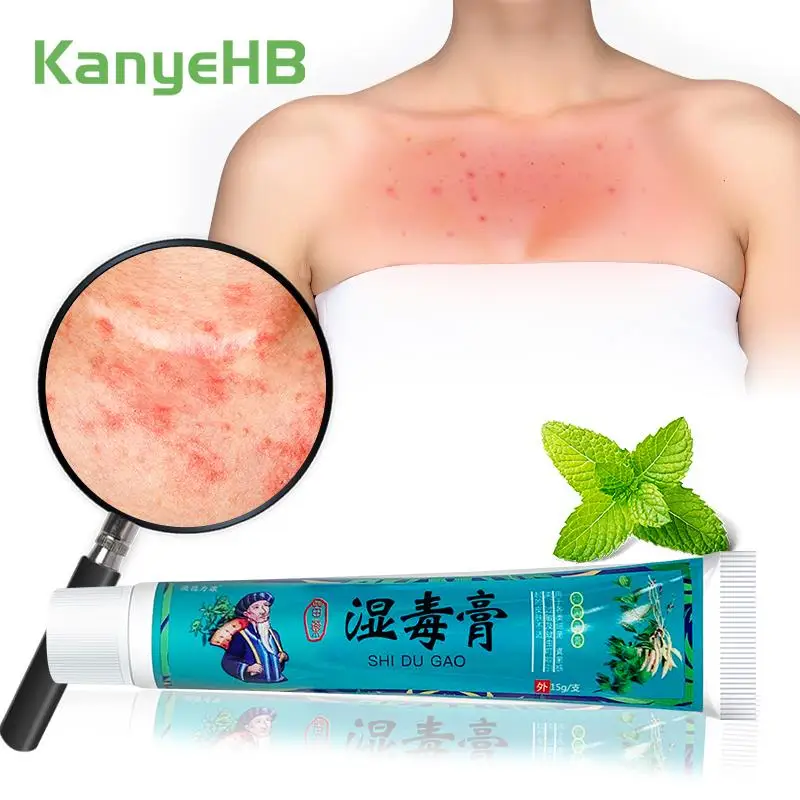 1 шт., травяной крем против зуда, ингибитор грибков, Лечебный крем, восстанавливающий кожу, мазь для ухода за комарами S068
