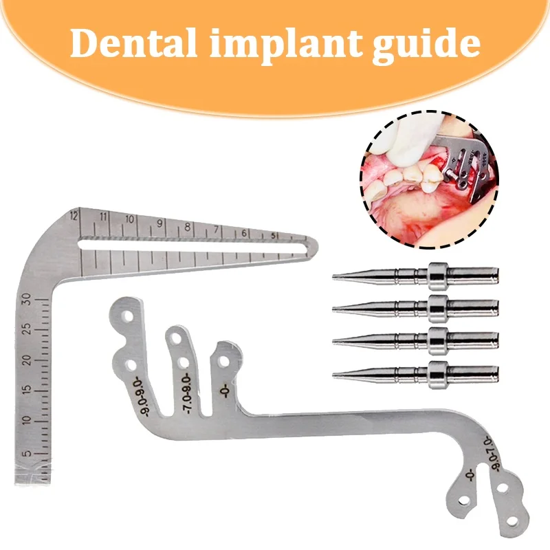 Направляющая для зубного импланта набор определения местоположения