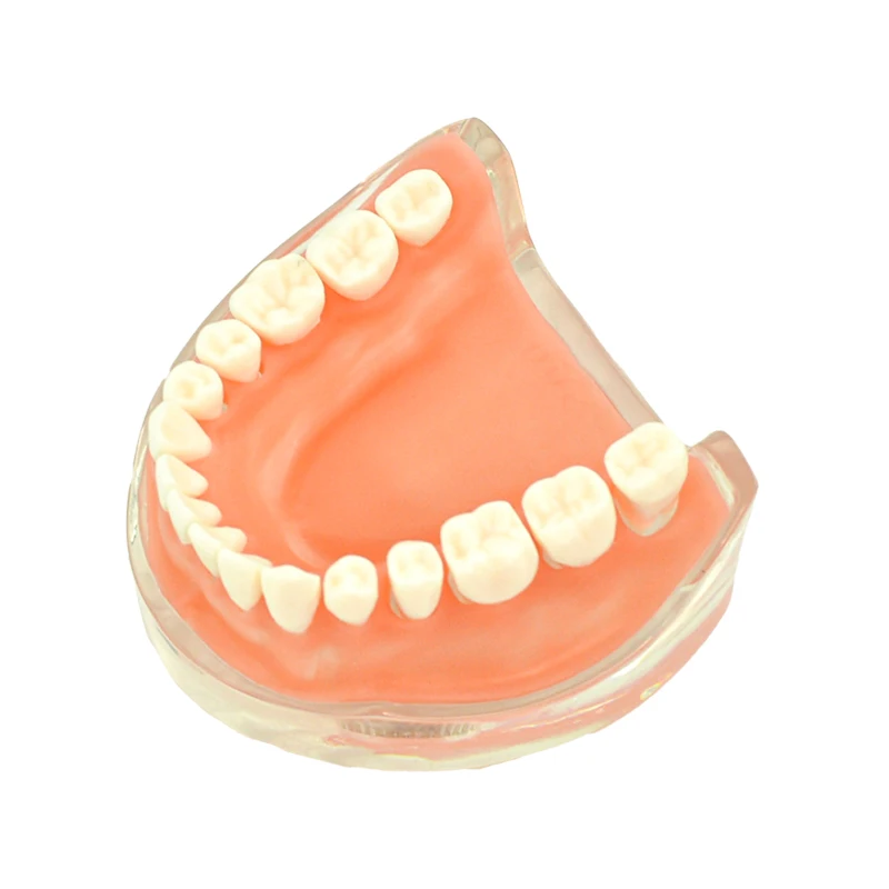 

Модель зубных имплантатов для восстановления зубов со съемным мостом обучающая модель для обучения стоматологу обучающая модель стоматологического инструмента