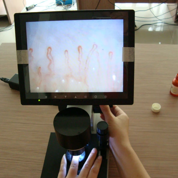

capillary microscope analyse subhealth microcirculation image analyser