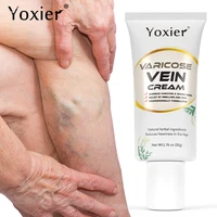 varicose vein cream treatment relieve dilated capillary removal phlebitis spider leg pain relief improve swelling body care 50g