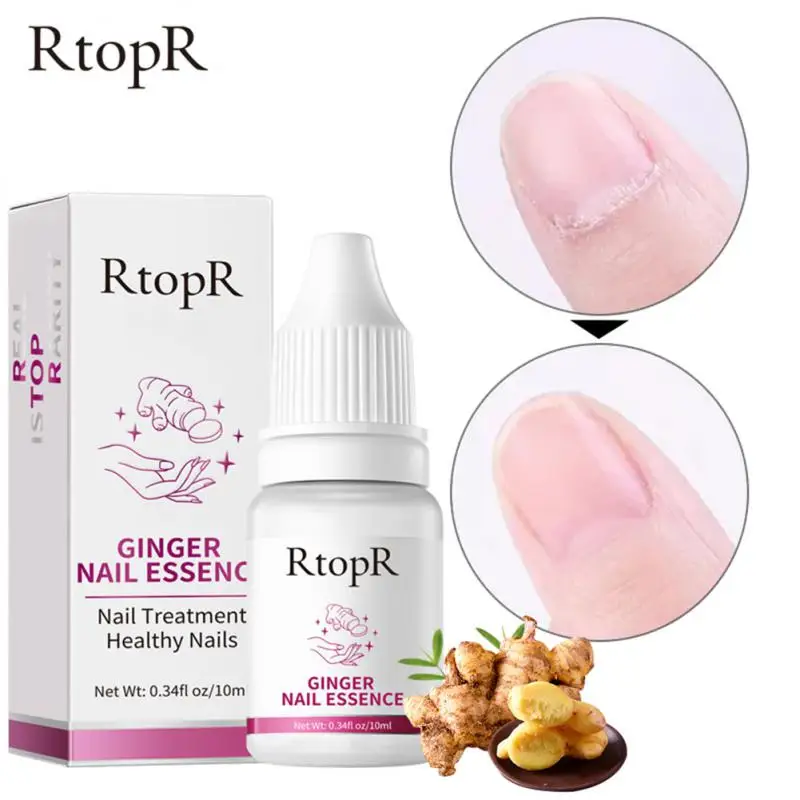 

2/3/5PCS Fungal Nail Oil Anti Nail Repair Feet Care Onychomycosis Removal Gel Liquid Antifungal Nail