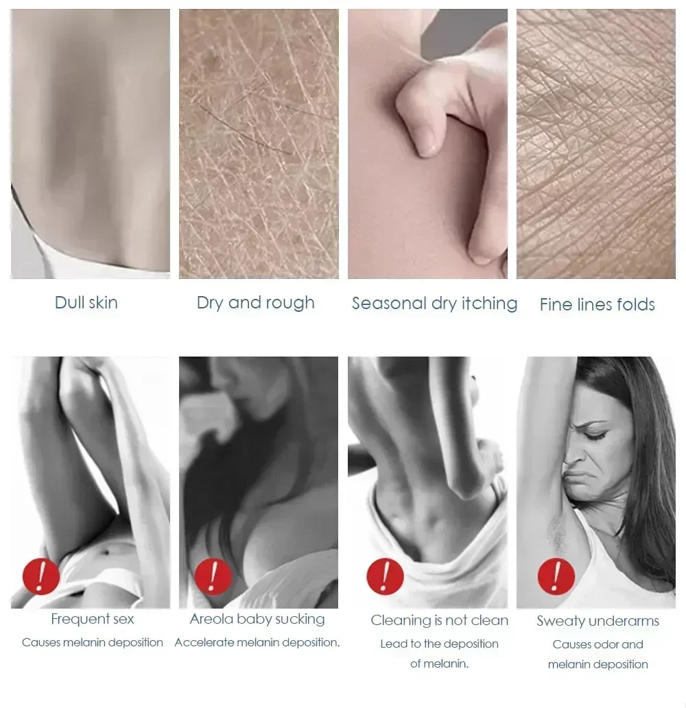 Осветляющий крем для лица тела бедра подмышек внутреннего меланина легкий