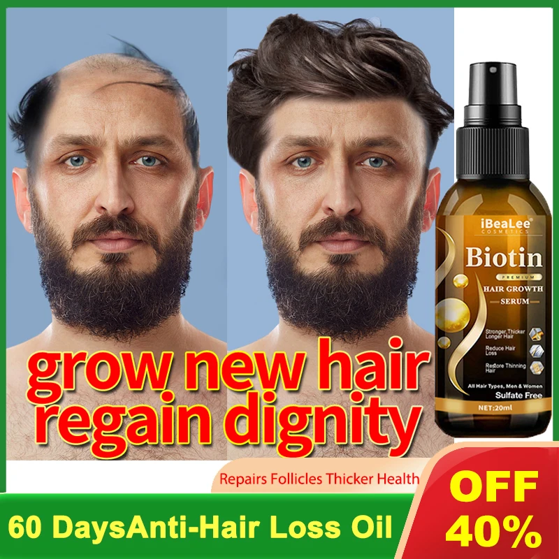 

Fast Hair Growth Spray Products Anti Hair Loss Serum Prevent Baldness Treatment Scalp Dry Damaged Beard Hair Care Essential Oils