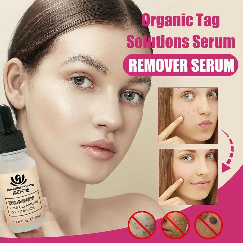 

20ML Effective Professional Skin Tag Remover Serum Tags Solutions Rose Extract Organic Spot Removal Anti aging Skin Care