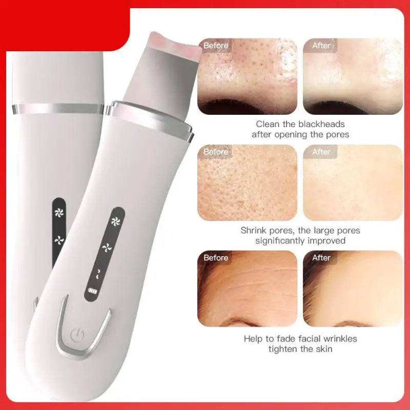 

Ultrasonic Electric Beauty Instrument Blackhead Removal Instrument Ion Introduction Cleansing Pores Dead Skin Beauty Device