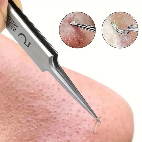 eTya пинцет для удаления прыщей